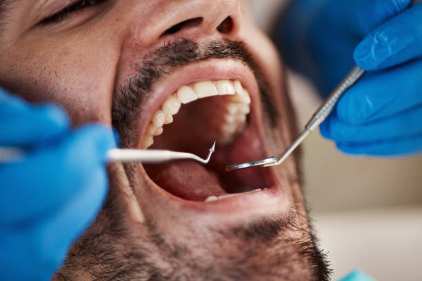 Best Emergency Treatment for Dental Infections or Abscesses in Evansdale, IA