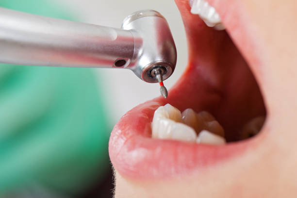 Best Emergency Gum Treatment in Evansdale, IA